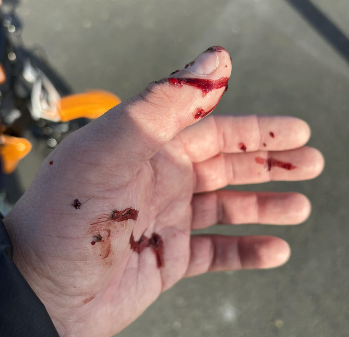 Horror dog attack, plastic windows, Christmas lights and more....