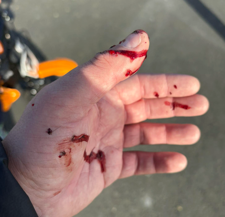 Horror dog attack, plastic windows, Christmas lights and more....